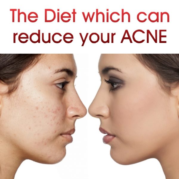 The Diet which can Reduce your Acne Dermal Face Mask Dermal Sheet